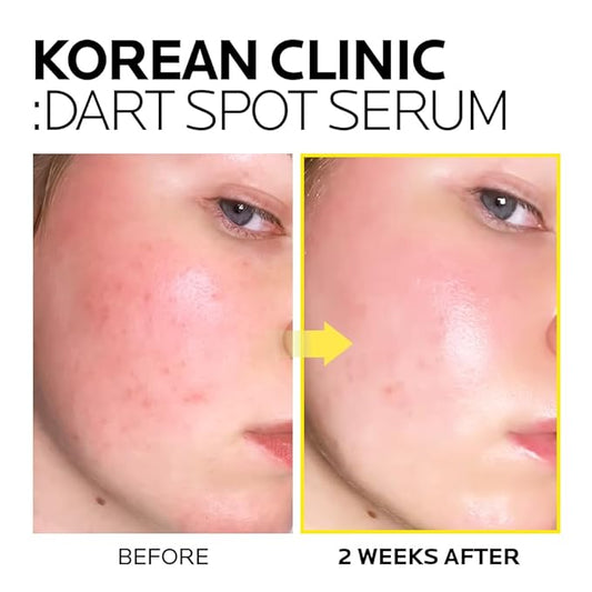 MIMUMIMU Dark Spot Remover Serum for Face | Korean Clinic Skincare - Thioctic Acid 0.01% & Niacinamide 5% | Spot Treatment for Melasma, Hyperpigmentation, Discoloration, Acne Scars | Pack of 2