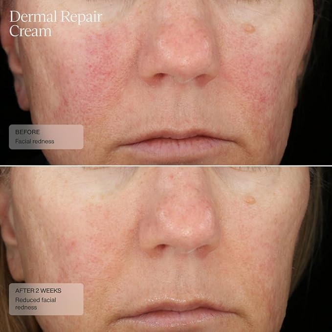 Senté The Repair Duo with Bio Complete Serum & Dermal Repair Cream - AntiAging Skincare Kit for Sensitive Skin, Fine Lines & Wrinkles, Redness & Deep Hydration.With Retinol & Vitamin E(1.0oz & 1.7oz)