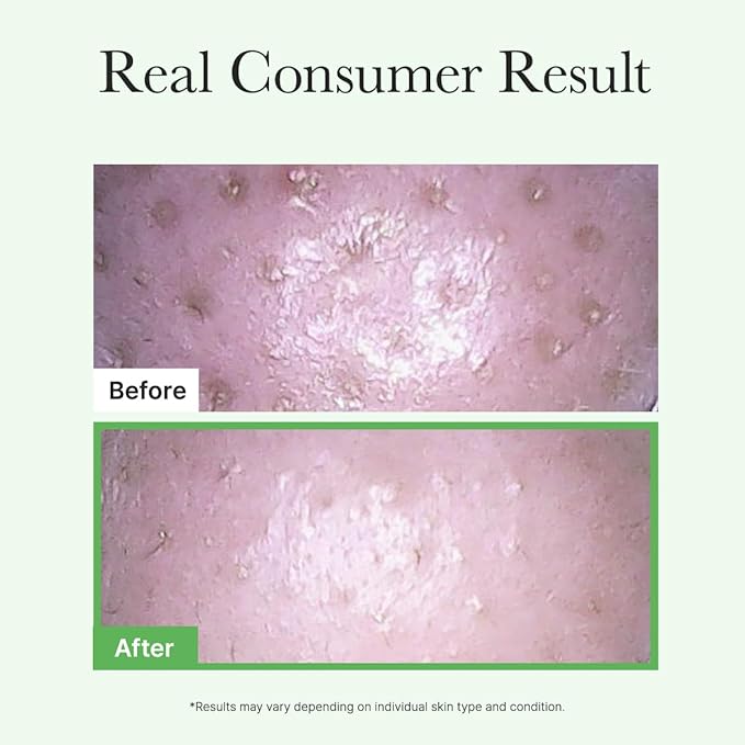 Pore Melt Mochi Makeup-Removing Cleansing Oil, Non-Comedogenic, Rice Amino Acids HD, Vitamin E, Cica, & Ceramide, 6.76 fl oz