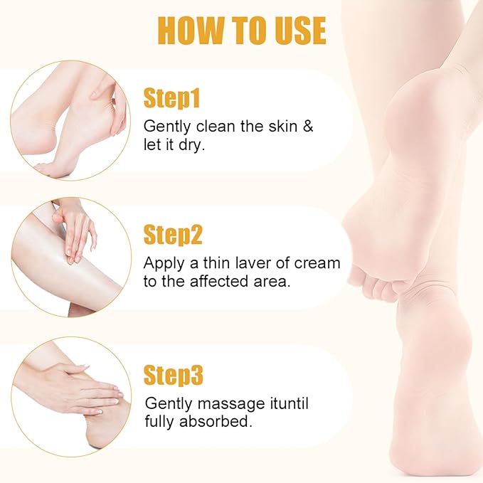 60% Urea Hydrating and Anti-Cracking Foot Cream, Upgraded Moisturising and Relieves Cracking and Dryness Foot Cream, Foot Lotion Heel Stick Repairs and Hydrates Dry and Cracked Feet and Hand