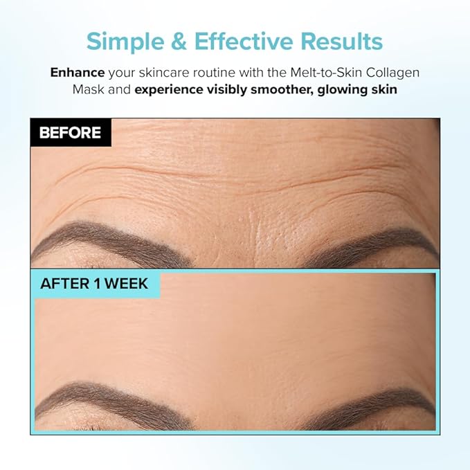 Melt to Skin Collagen Mask, – Wrinkle Patches for Forehead, Eyes & Smile Lines - Frown Lines, Eleven-Lines Repair Patches, Invisible Face Wrinkles Smoothers - Korean Skin Care, 4EA