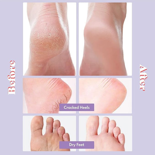 Toi:L Extra Silky Foot Mask 5 Pairs, Post-Peeling Foot Care Treatment, Moisturizing Socks with Guerande Salt & Sweet Almond Oil for Dry Feet, Cracked Heels, and Callus