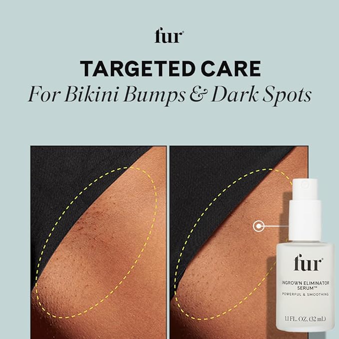 Fur Ingrown Eliminator Serum: Post Hair Removal Care and Ingrown Hair Treatment - 1.1 FL OZ