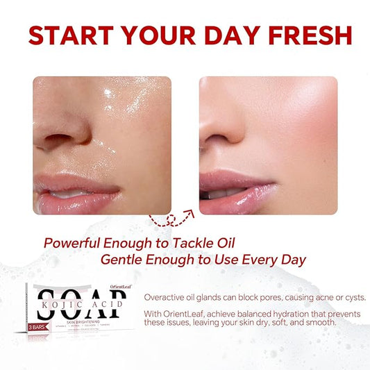 Kojic Acid Soap, Turmeric Soap Bar for Dark Spots, Fresh Citurs Scent, Gentle for Face and Body Wash with Vitamin C, Shea Butter, Retinol, Olive Oil, Collagen (3 PACK)