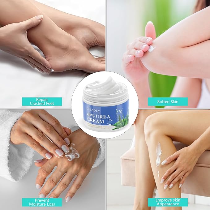 2 Packs Urea Cream 40 Percent for Feet Maximum Strength, Urea Foot and Hand Cream with Powerful Hydration for Dry Skin, Cracked Heels, Deeply Moisturizing for All Skin Types 7.05oz