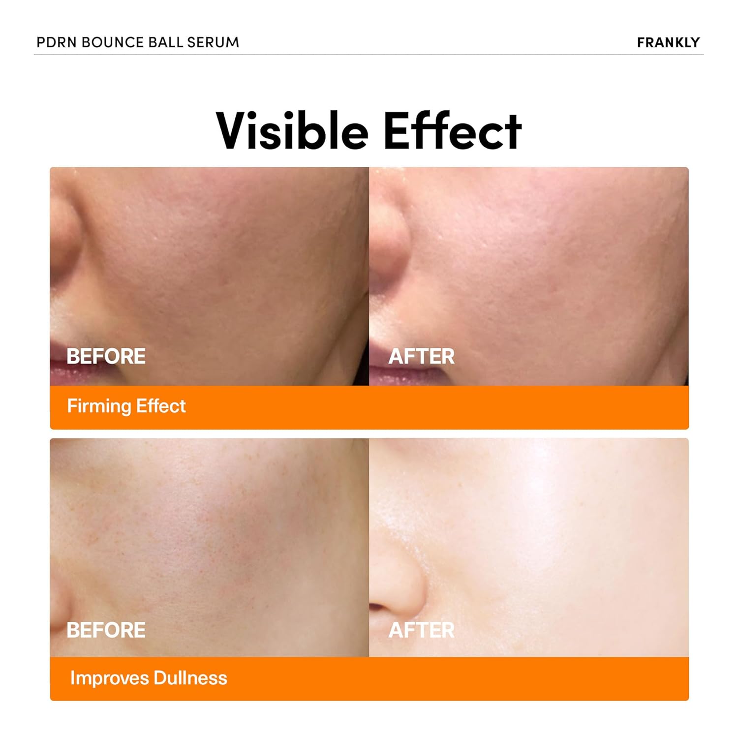 PDRN Bounce Ball Serum – Korean Salmon DNA Face Serum for Glass Skin, Plumping & Firming – Lightweight, Non-Sticky Glow Serum for Bouncy, Hydrated Skin – 1.01 Fl Oz