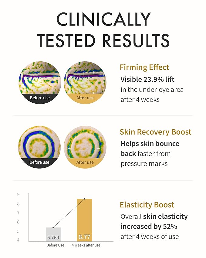 REJURAN® Turnover Active Cream Enhanced, DOT™ c-PDRN® – Deep Rejuvenation Salmon DNA PDRN Face Moisturizer for Collagen Boosting, Skin Elasticity, Firming, and Lifting. Korean Skincare. (1.69 fl oz)