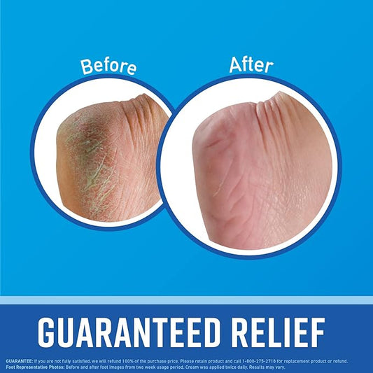 O'Keeffe's for Healthy Feet Foot Cream; Guaranteed Relief for Extremely Dry; Cracked Feet; Instantly Boosts Moisture Levels; 3.2 Ounce Jar; (Pack of 3)