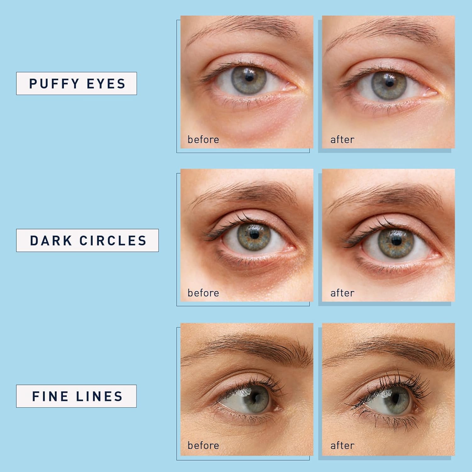 under Eye Patches for Dark Circles: 30 Pairs Retinol Collagen Eye Gels Mask - Reduce Wrinkles Puffy & Bags - Skin Treatment Pads - anti Aging Moisturizer for Women (Blue)