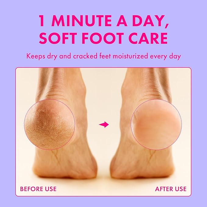 Foot Cream for Long-Lasting Odor Control (Neutralizes Odor at the Source) (Hydrates Dry, Cracked Feet) with Natural Mushroom Extract