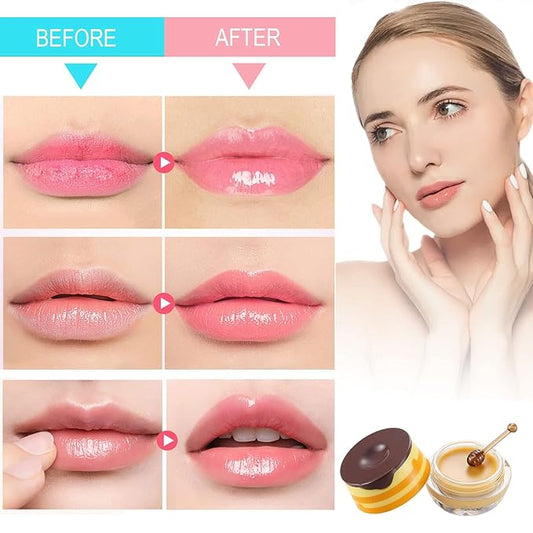 Honey Lip Balm Pot - Moisturizing Lip Mask with Propolis - Prevents Dry, Cracked Lips - Exfoliator (1 Pack)