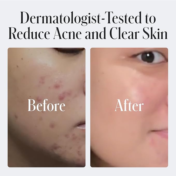 Geologie Daily Face Wash for Sensitive Skin | Fragrance-Free Facial Cleanser for Men & Women | Acne & Oil Control | Non-irritating, Gentle Cleansing & Soothing Face Wash | 2-Pack