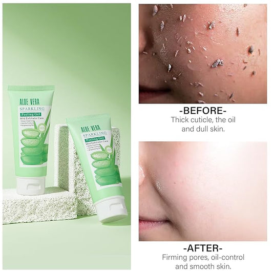 Purifying Exfoliating Peeling Gel Aloe Vera Sparkling Peeling Gel, Deep Cleansing Face Body Scrub Exfoliating Face Wash Facial Scrub Exfoliator Exfoliant Facial, Dead Skin Remover 3.38 FLOZ