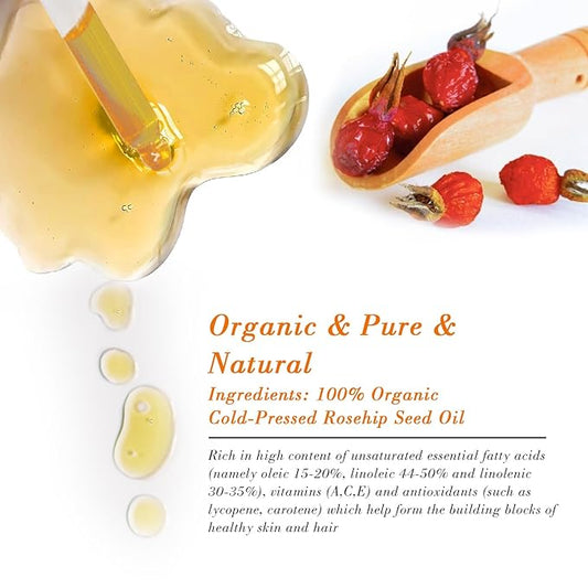 Rosehip Seed Oil for Face (2 oz/60 ml) USDA Certified Organic 100% Pure Natural Cold Pressed Unrefined Rosehip Oil for Skin Anti-Aging, Scar, Hair Moisturizer, Gua Sha Massage, Nails