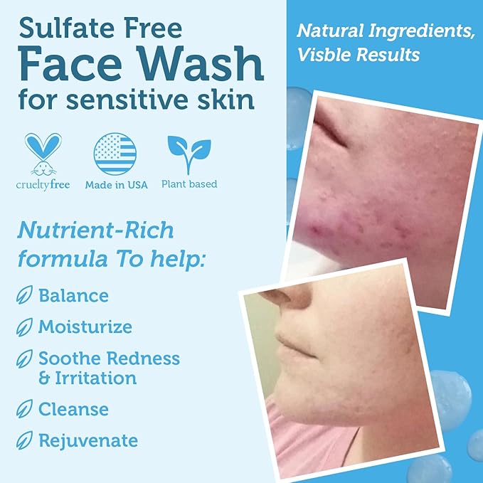 Era Organics Manuka Honey Face Wash for Women, Men - Sulfate Free Moisturizing Cleanser, Organic Aloe Vera - Soothing Plus Gentle on Dry Skin Facial Cleanser Made in USA - 8oz