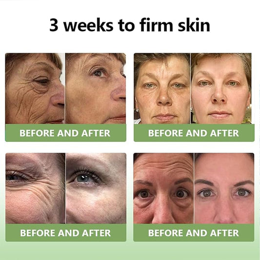 STDEI Luxurious Collagen Firming Cream，Advanced Firming Cream, Skin Tightening, Deep Moisturizing, For All Areas of the Body (2)
