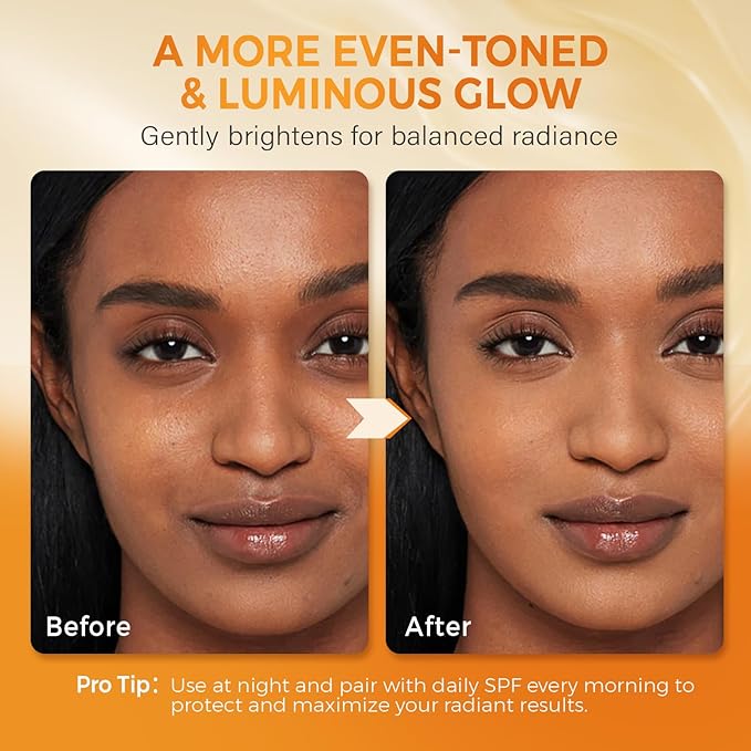 QOOQ Turmeric Kojic Acid Soap for Dark Spots Brightening – Face and Body Wash with Vitamin C, Retinol, Collagen, Vitamin E, Glycerin, Shea Butter & Castile Olive Oil – Soap for Women & Men (100g)