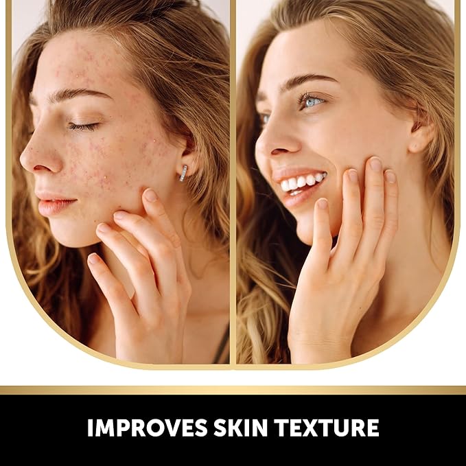 VALITIC Kojic Acid Vitamin C and Retinol Soap Bars with Turmeric for Dark Spot - Original Japanese Complex Infusedwith Collagen, Hyaluronic Acid, Vitamin E (2 Pack) - With Scrub Bag