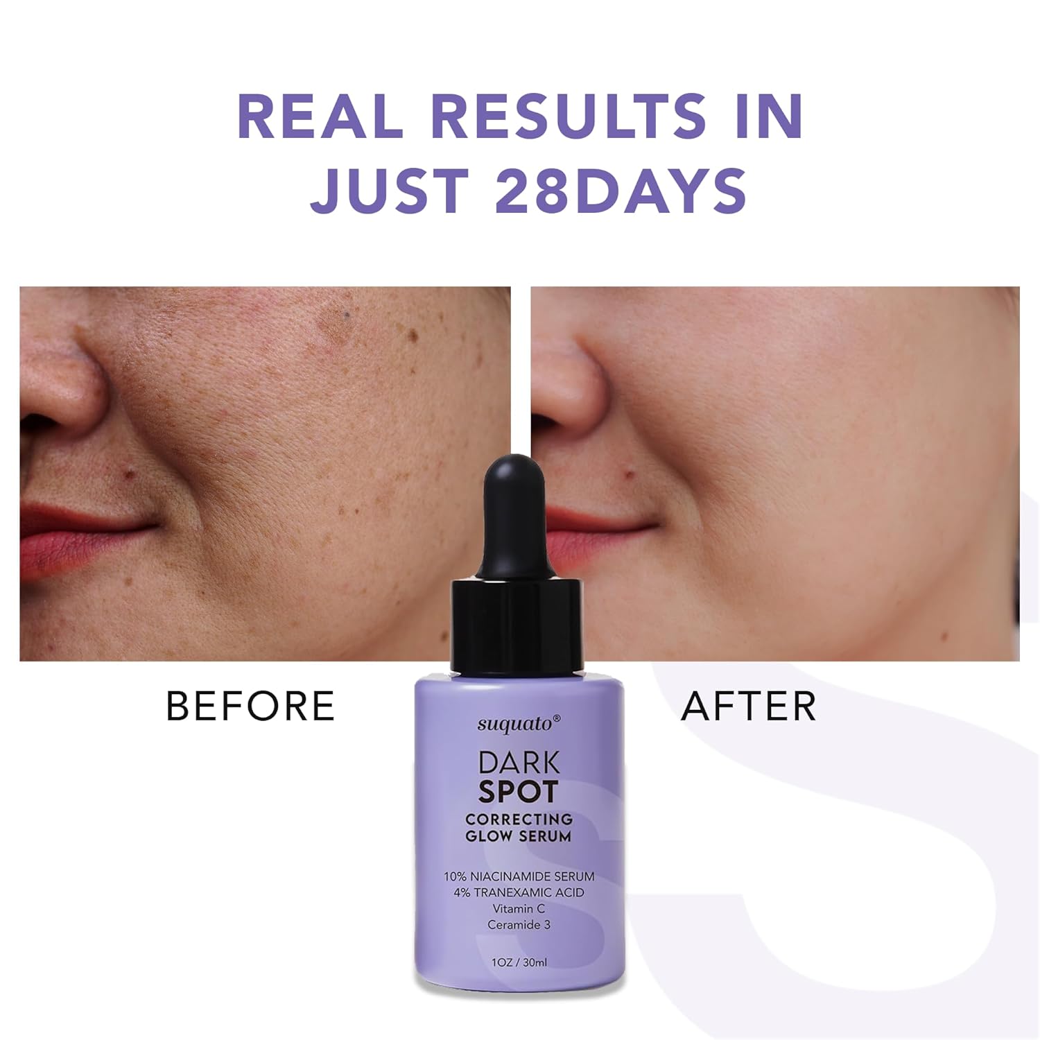 ✨ Dark Spot Correcting Glow Serum – Tranexamic Acid & Vitamin C
