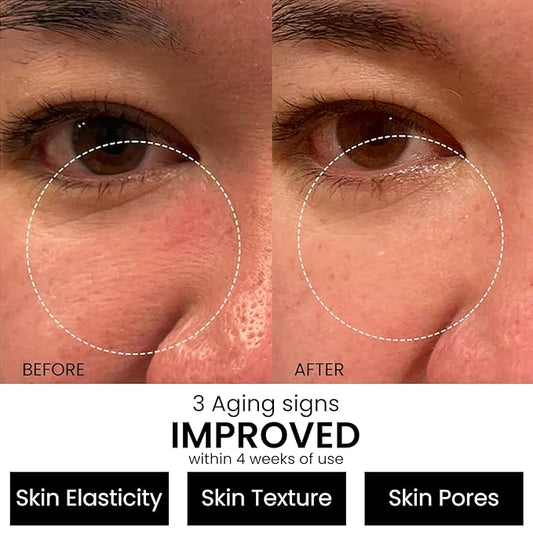 Retinol Serum 2.5% for Face Anti Aging Serum with Hyaluronic Acid to Minimize Wrinkles. Improves Sun Damaged Skin and Fades Dark Spots - Vitamin A Serum - Dermatologist Tested & MADE in USA
