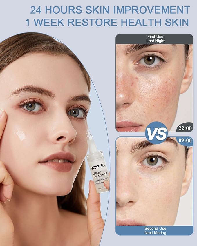 Ceramide Serum for Skin Barrier Repair, Hydrating Serum to Reduce Dryness and Wrinkles, 5% Ceramide Face Serum Ampoule Solution 2 Vials
