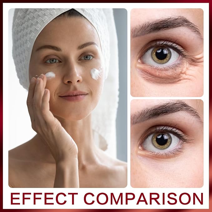 Retinol Anti Aging Face Moisturizer Creams for Face, Collagen Cream With Hyaluronic Acid, Face Lift Cream for Skin Tightening and Firming, Wrinkle Smoother for Women & Men