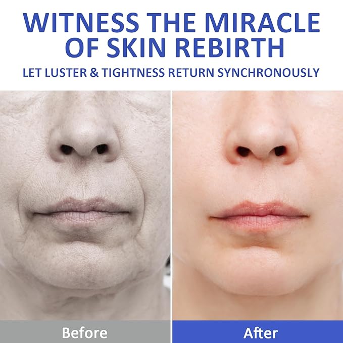 Volufiline Serum, Face Serum Anti Wrinkle, Moisturize and Firm Skin, Improve Fine Lines and Sagging Problems, Enhance Skin Fullness and Firmness
