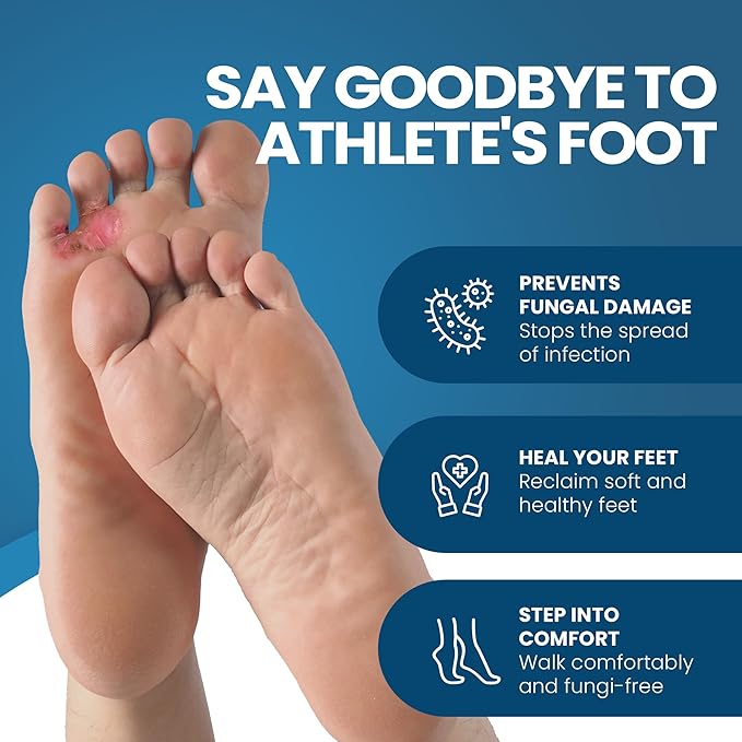 FUNGINIX AF Athletes Foot Cream - Topical Anti-Fungal Treatment, Eliminates Athlete's Foot Infections, Safe & Effective (2 Tubes)