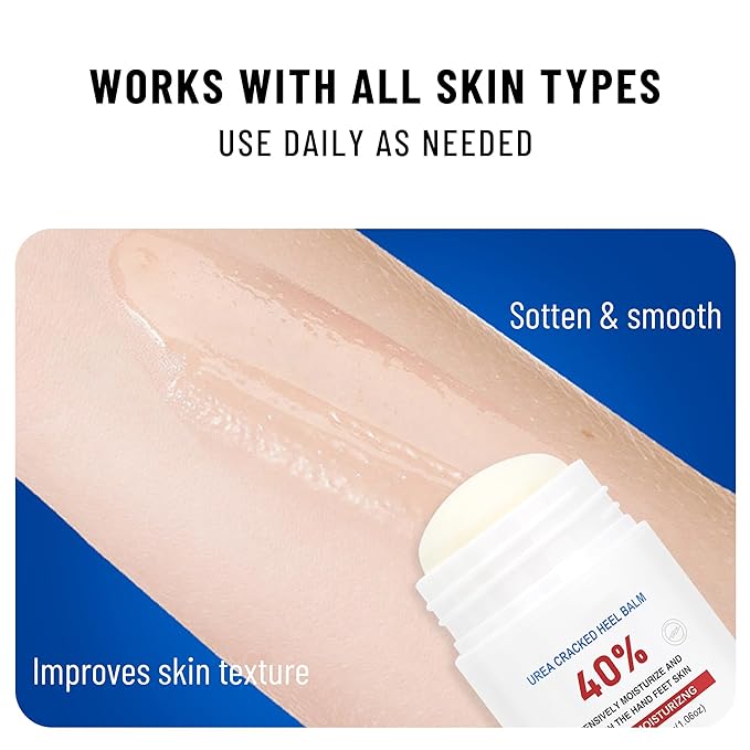 OUKEYA Urea Cream Stick 40 Percent,Heel Balm,Hand Cream and Foot Cream for Dry Cracked,Cracked Heel Treatment,Avoid Frostbite,40 Percent Urea Lotion for Feet Maximum Strength