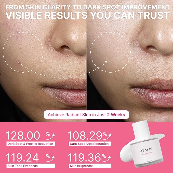 Toning Active Ampoule–Brightening, Hydrating&Soothing with Tranexamic Acid, Niacinamide&Hyaluronic Acid, Dark Spot Correction, Gentle for Sensitive Skin, Korean Skin Care, 50ml/1.69 fl.oz