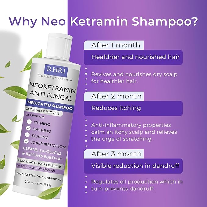 Anti Fungal Shampoo for Men & Women | Anti Dandruff, Medicated, Folliculitis Shampoo for Dry Scalp, Psoriasis, Ringworm | for Itchy, Flaky & Irritated Scalp | No Paraben & Sulphate
