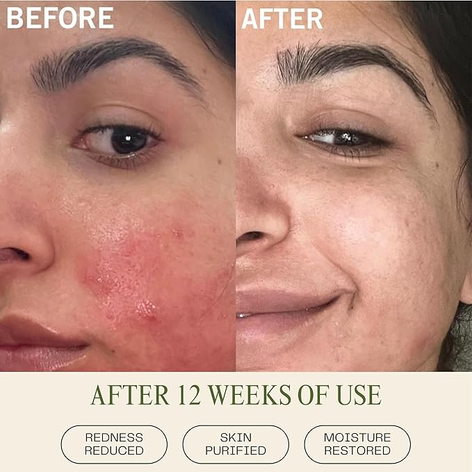 Mudita Earth Vitamin C Cleanser – 4 fl oz | Peach & Basil Balancing Face Wash | Gentle Sulfate-Free Cleanser for Sensitive, Oily & Acne-Prone Skin, Lactic Acid Polish