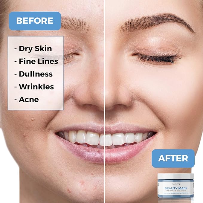 Teami Beauty Facial Mask - Moisturizing Face Mask Skin Care - Anti Acne & Blackhead Remover with Butterfly Pea Flower & Kaolin Clay - Deep Cleansing Face Mask for Oily, Dry, or Sensitive Skin