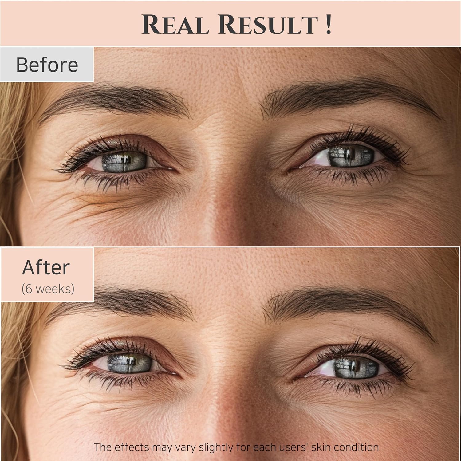 ✨ Revive Retinal Eye Serum – Korean Anti-Aging Eye Treatment for Dark Circles & Puffiness (30ml)