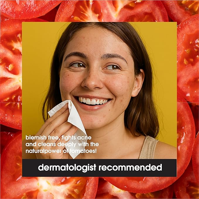 Yes To Tomatoes Clear Skin Acne Fighting Facial Wipes, Acne Prone Skin + Helps Control Oil + Salicylic Acid + 95% Natural Ingredients, 30 Count (Pack of 2)