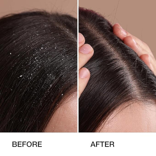 GK HAIR Anti Dandruff Shampoo 8.5 Fl Oz & Moisturizing Conditioner for Color Treated Dry Damage Curly Frizzy Thinning 10.1 Fl Oz